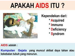 APAKAH AIDS ITU ?
                           Kependekan dari:
                               * Acquired
                               * Immuno
                               * Deficiency
                               * Syndrom

AIDS adalah :
Kumpulan Gejala yang muncul akibat daya tahan atau
kekebalan tubuh yang menurun.
 