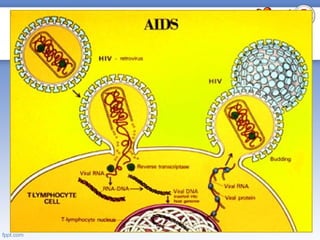 HIV AIDS