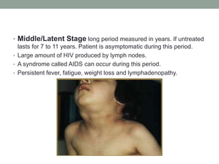• Middle/Latent Stage long period measured in years. If untreated
lasts for 7 to 11 years. Patient is asymptomatic during this period.
• Large amount of HIV produced by lymph nodes.
• A syndrome called AIDS can occur during this period.
• Persistent fever, fatigue, weight loss and lymphadenopathy.
 