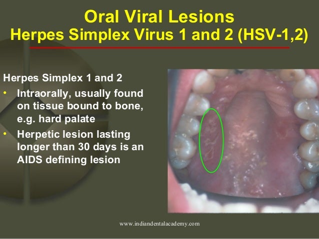 Hiv/endodontic courses