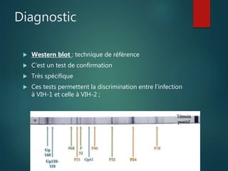 Diagnostic
 Western blot : technique de référence
 C’est un test de confirmation
 Très spécifique
 Ces tests permettent la discrimination entre l’infection
à VIH-1 et celle à VIH-2 ;
 