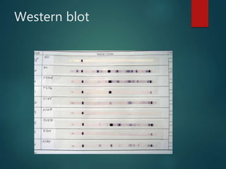 Western blot
 