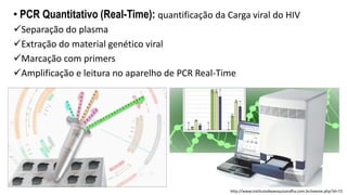• PCR Quantitativo (Real-Time): quantificação da Carga viral do HIV
Separação do plasma
Extração do material genético viral
Marcação com primers
Amplificação e leitura no aparelho de PCR Real-Time
http://www.institutodepesquisarafha.com.br/exame.php?id=72
 