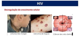 HIV
Desregulação do crescimento celular
 