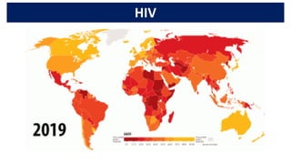HIV
 