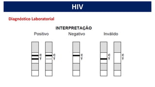 HIV
Diagnóstico Laboratorial
 