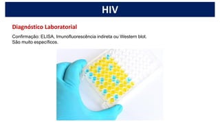 HIV
Confirmação: ELISA, Imunofluorescência indireta ou Western blot.
São muito específicos.
Diagnóstico Laboratorial
 