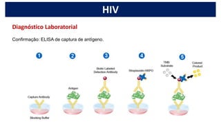 HIV
Confirmação: ELISA de captura de antígeno.
Diagnóstico Laboratorial
 