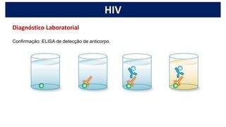 HIV
Confirmação: ELISA de detecção de anticorpo.
Diagnóstico Laboratorial
 