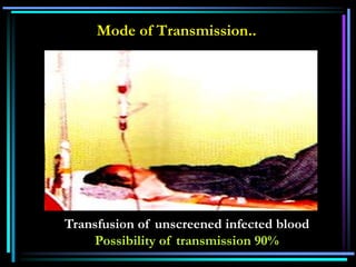 Mode of Transmission..
Transfusion of unscreened infected blood
Possibility of transmission 90%
 