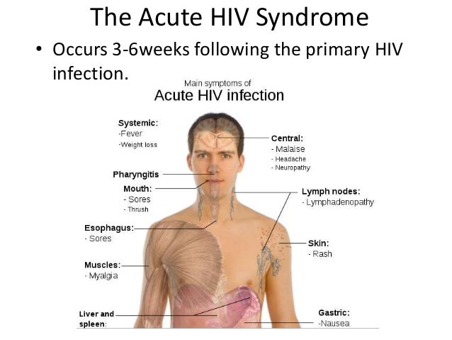 swollen lymph nodes hiv