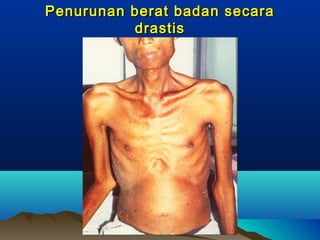 Penurunan berat badan secaraPenurunan berat badan secara
drastisdrastis
 