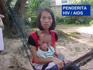 PENDERITA
HIV / AIDS
 