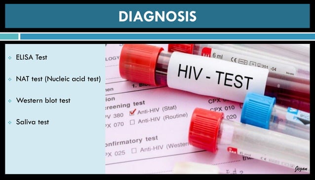 Pathophysiology of HIV AIDS | PDF | Infectious Diseases | Diseases and ...