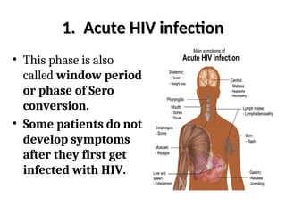 1. Acute HIV infection
1. Acute HIV infection
• This phase is also
called window period
or phase of Sero
conversion.
• Some patients do not
develop symptoms
after they first get
infected with HIV.
 