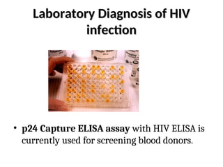 Laboratory Diagnosis of HIV
Laboratory Diagnosis of HIV
infection
infection
• p24 Capture ELISA assay with HIV ELISA is
currently used for screening blood donors.
 
