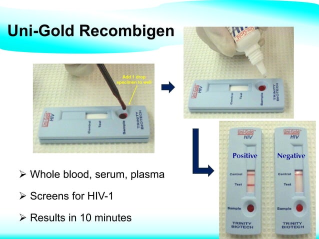 Laboratory diagnosis and monitoring of HIV | PDF | Infectious Diseases ...