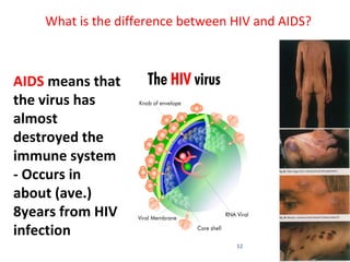 What is the difference between HIV and AIDS?



AIDS means that
the virus has
almost
destroyed the
immune system
- Occurs in
about (ave.)
8years from HIV
infection
                                   12
 