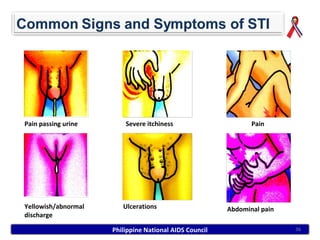 Pain passing urine       Severe itchiness                      Pain




Yellowish/abnormal      Ulcerations                     Abdominal pain
discharge

                     Philippine National AIDS Council                    36
 