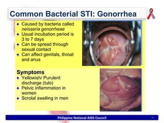 ♠ Caused by bacteria called
  neisseria gonorrheae
♠ Usual incubation period is
  3 to 7 days
♠ Can be spread through
  sexual contact
♠ Can affect genitals, throat
  and anus

Symptoms
♠ Yellowish/ Purulent
  discharge (tulo)
♠ Pelvic inflammation in
  women
♠ Scrotal swelling in men



                    Philippine National AIDS Council   37
 