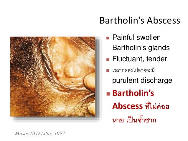 Hiv รพช2015 2.ppt
