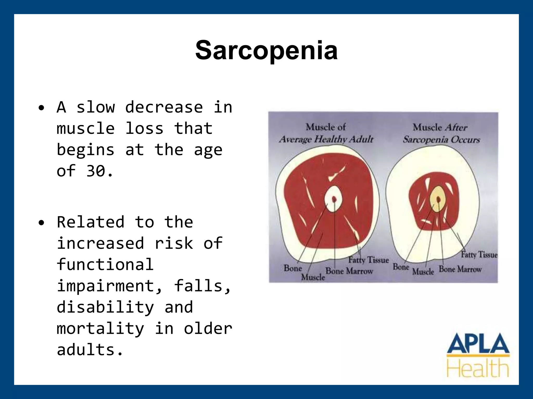 Sarcopenia
• A slow decrease in
muscle loss that
begins at the age
of 30.
• Related to the
increased risk of
functional
impairment, falls,
disability and
mortality in older
adults.
 