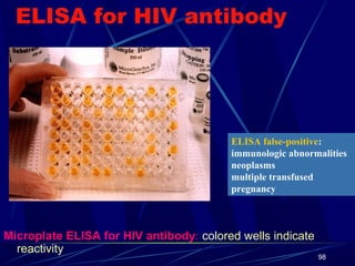 ELISA for HIV antibody

ELISA false-positive:
immunologic abnormalities
neoplasms
multiple transfused
pregnancy

Microplate ELISA for HIV antibody: colored wells indicate
reactivity

98

 