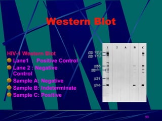 Western Blot
HIV-1 Western Blot
Lane1 : Positive Control
Lane 2 : Negative
Control
Sample A: Negative
Sample B: Indeterminate
Sample C: Positive

99

 