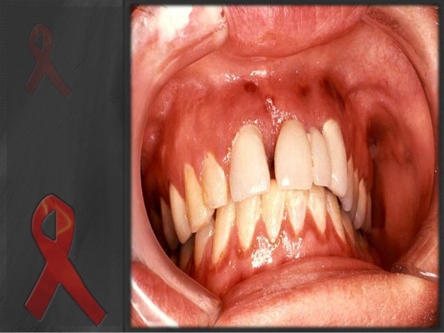 pregnancy proper test use HIV AIDS pregnancy proper test use HIV AIDS