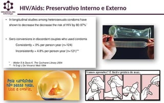 HIV/Aids: Preservativo Interno e Externo
 