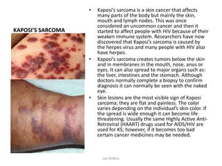 KAPOSI’S SARCOMA
• Kaposi’s sarcoma is a skin cancer that affects
many parts of the body but mainly the skin,
mouth and lymph nodes. This was once
considered an uncommon cancer and then it
started to affect people with HIV because of their
weaken immune system. Researchers have now
discovered that Kaposi’s sarcoma is caused by
the herpes virus and many people with HIV also
have herpes.
• Kaposi’s sarcoma creates tumors below the skin
and in membranes in the mouth, nose, anus or
eyes. It can also spread to major organs such as:
the liver, intestines and the stomach. Although
doctors normally complete a biopsy to confirm
diagnosis it can normally be seen with the naked
eye.
• Skin lesions are the most visible sign of Kaposi
sarcoma; they are flat and painless. The color
varies depending on the individual’s skin color. If
the spread is wide enough it can become life
threatening. Usually the same Highly Active Anti-
Retroviral (HAART) drugs used for AIDS/HIV are
used for KS; however, if it becomes too bad
certain cancer medicines may be needed.
Joy Wilkins
 