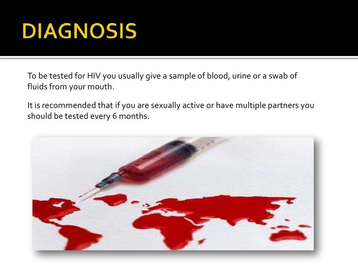 how reduce to fever your HIV/AIDS powerpoint how reduce to fever your HIV/AIDS powerpoint