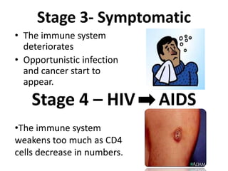 Stage 3- Symptomatic
• The immune system
deteriorates
• Opportunistic infection
and cancer start to
appear.
Stage 4 – HIV AIDS
•The immune system
weakens too much as CD4
cells decrease in numbers.
 