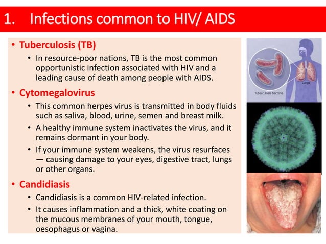 HIV AIDS - Risk factor, Clinical feature & Complication | PPT | Free ...