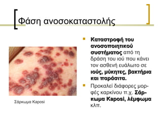 Φάση ανοσοκαταστολής
 Καταστροφή τουΚαταστροφή του
ανοσοποιητικούανοσοποιητικού
συστήματοςσυστήματος από τη
δράση του ιού που κάνει
τον ασθενή ευάλωτο σε
ιούς, μύκητες, βακτήριαιούς, μύκητες, βακτήρια
και παράσιτα.και παράσιτα.
 Προκαλεί διάφορες μορ-
φές καρκίνου π.χ. Σάρ-Σάρ-
κωμακωμα Kaposi,Kaposi, λέμφωμαλέμφωμα
κλπ.
Σάρκωμα Kaposi
 