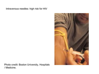 Hiv aids update | PPT