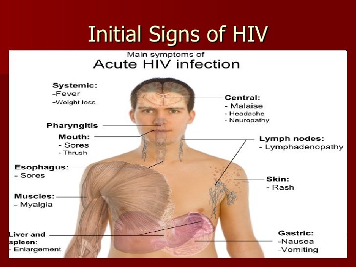 Hiv, Aids, & Your Immune System, Sped 554