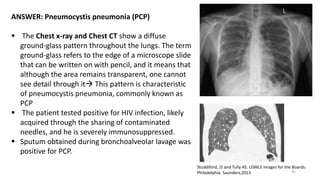 45
Studdiford, JS and Tully AS. USMLE Images for the Boards:
Philadelphia. Saunders,2013
ANSWER: Pneumocystis pneumonia (P...