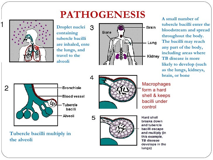 Effect of BCG vaccination against Mycobacterium ...