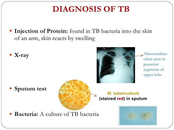sputum test under fontanacountryinn com sputum test