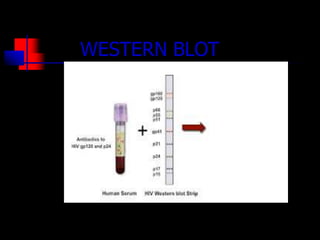 WESTERN BLOT
 