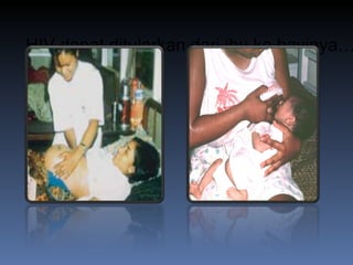 HIV dapat ditularkan dari ibu ke bayinya…  WHO 