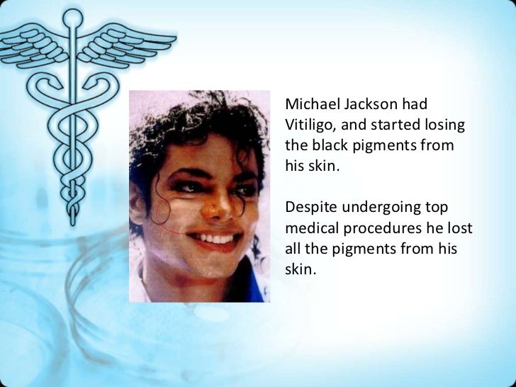 Leucoderma Vitiligo Natural Cure Leucoderma Vitiligo Natural Cure
