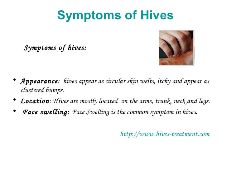 What are the symptoms of hives?