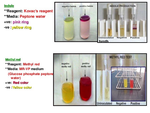 A Series Of Biochemical Tests