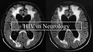 HIV in Neurology
 