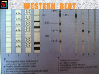 WESTERN BLOT
 