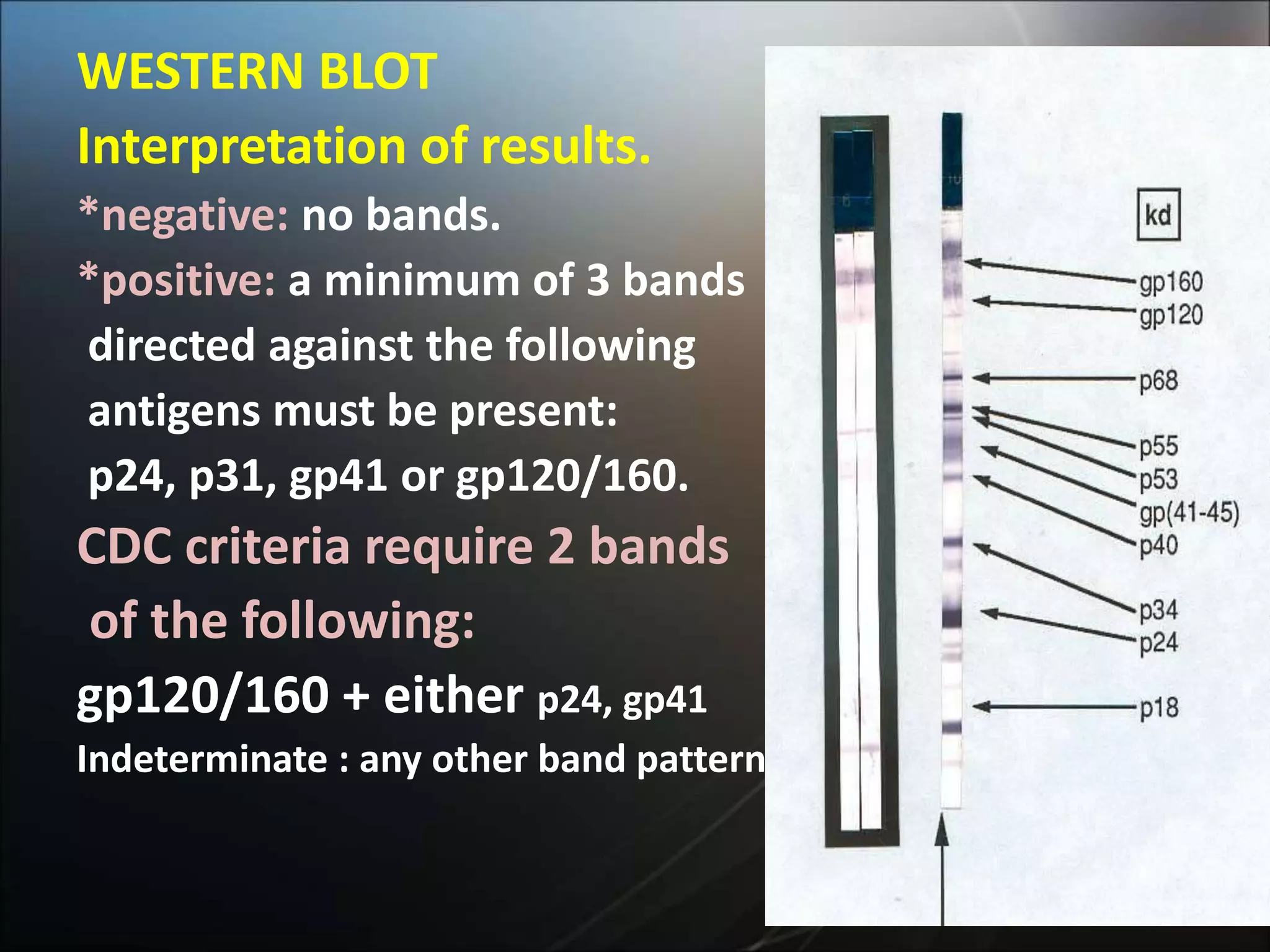 WESTERN BLOT
Interpretation of results.
*negative: no bands.
*positive: a minimum of 3 bands
directed against the following
antigens must be present:
p24, p31, gp41 or gp120/160.
CDC criteria require 2 bands
of the following:
gp120/160 + either p24, gp41
Indeterminate : any other band pattern
 