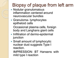 Biopsy of plaque from left arm
 Nodular granulomatous
inflammation centered around
neurovascular bundles
 Granuloma- lymphocytes
epitheloid cells
Occasional plasma cells, foreign
body and Langhans giant cells
 Infiltration of dermo-epidermal
junction
 Small amount of lymphocytic
nuclear dust suggests Type I
reaction.
IMPRESSION: BT Hansens with
mild type I reaction
 