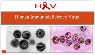 Human Immunodeficiency Virus
1
 